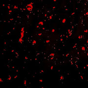Speckle Bred Shorts