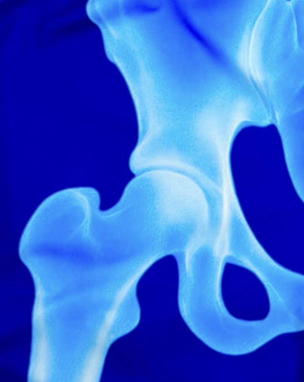 X-Ray Soft-QD Basketball Shorts — Premium Performance