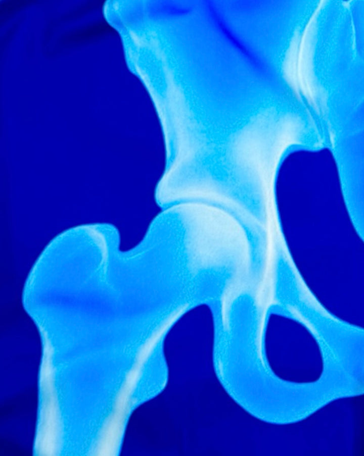 X-Ray Soft-QD Basketball Shorts — Premium Performance