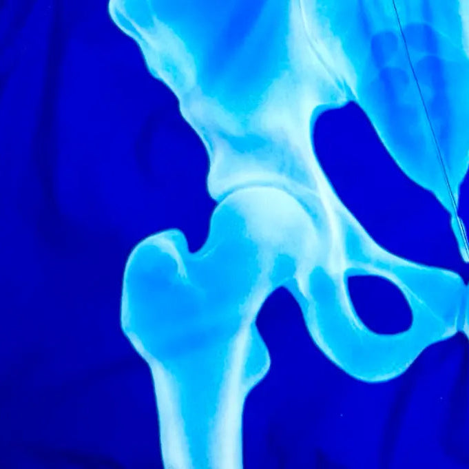 X-Ray GO Shorts